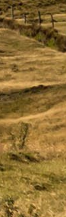 Gangnam Ulthera Prime: Shall We Explore the Story Behind the Upgraded Ulthera Together? image 35