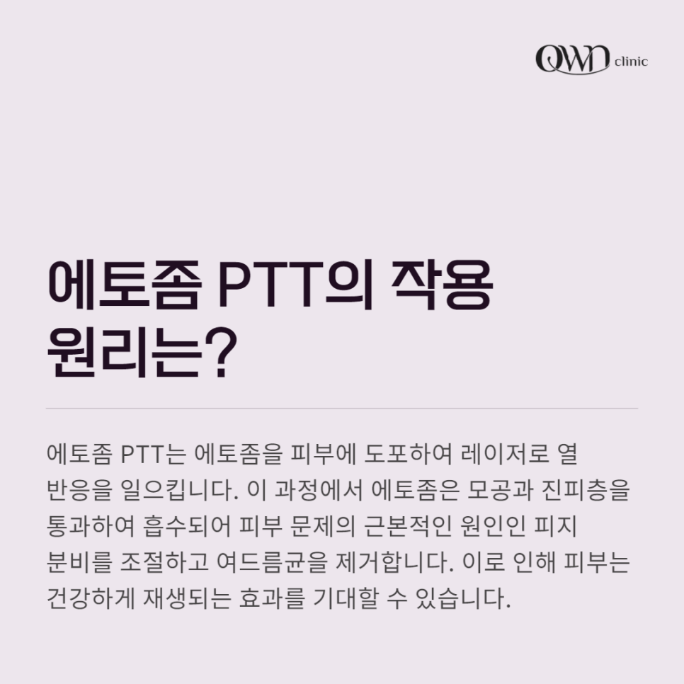 강남에토좀PTT, 여드름 개선이 필요할 때, 선택해야 하는 이유 관련 이미지 4