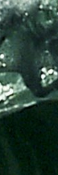 Samseong-dong Acne Treatment, The Key Is Preventing Recurrence. | Capri Laser image 24