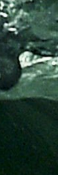 Samseong-dong Acne Treatment, The Key Is Preventing Recurrence. | Capri Laser image 25