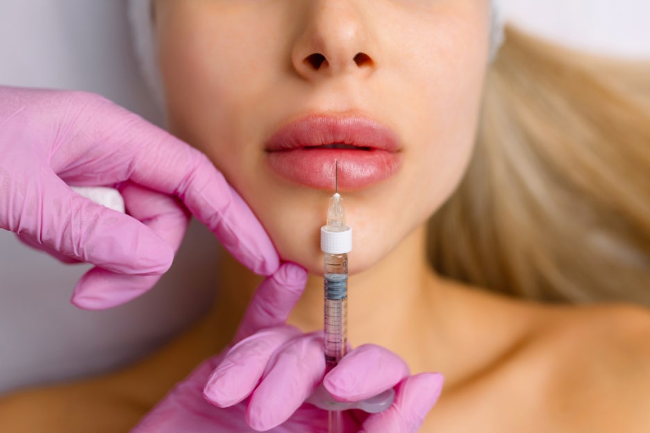 Samsung Station Dermatology Clinic, Lip Filler: It May Look Simple, but It Is by No Means a Simple Procedure. image 6