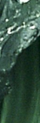 Samseong-dong Acne Treatment, The Key Is Preventing Recurrence. | Capri Laser image 13