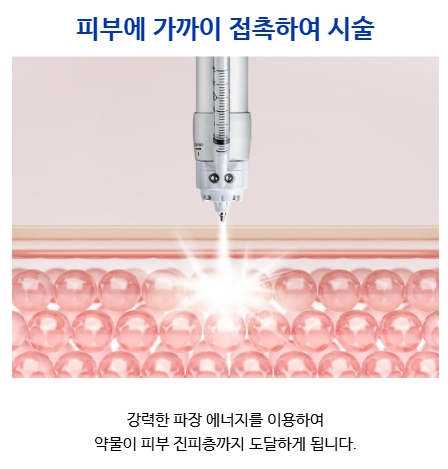 Samsung Station Dermatology Clinic Recommendation, Scar Treatment Without Needles? What Are the Principle and Effects of Cure-Jet? image 5