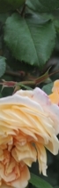 삼성역필러, 목주름, 숨기고만 싶으셨나요?간단한 시술로 자신감 UP하는 방법 관련 이미지 37