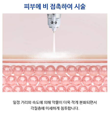 Samsung Station Dermatology Clinic Recommendation, Scar Treatment Without Needles? What Are the Principle and Effects of Cure-Jet? image 4
