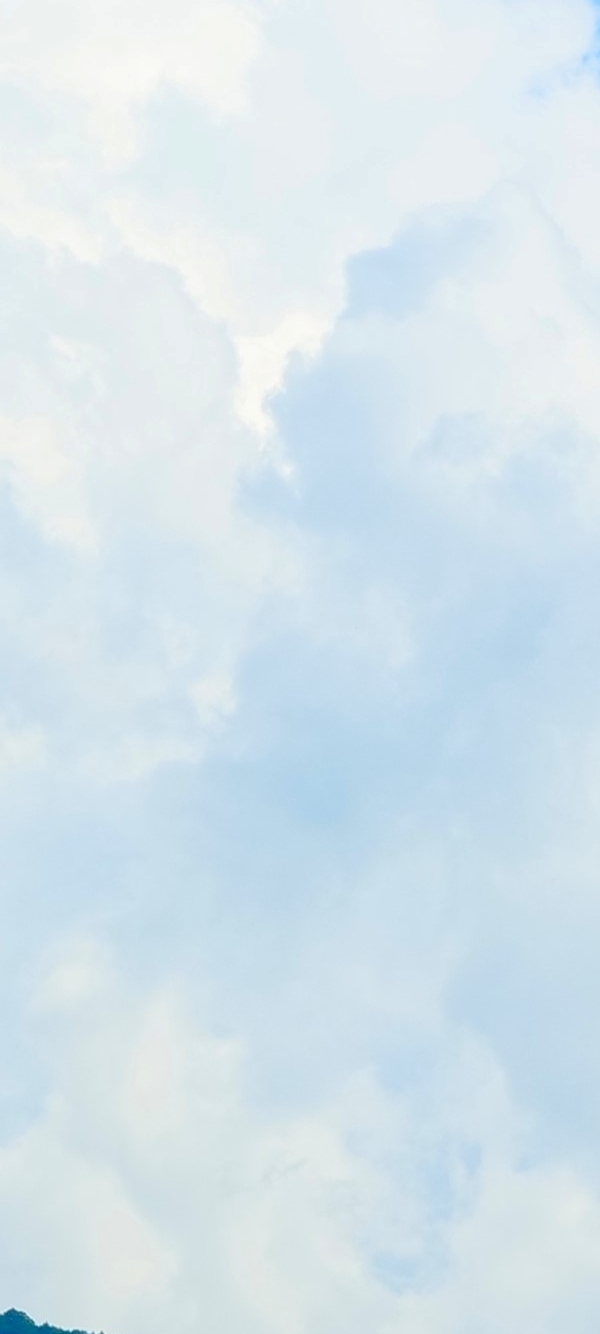 삼성동실리프팅, 맞춤형 디자인으로 더욱 만족스러운 결과를 기대할 수 있어요. 관련 이미지 20