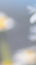 Samsung Station Dermatology Clinic, Lip Filler: It May Look Simple, but It Is by No Means a Simple Procedure. image 10