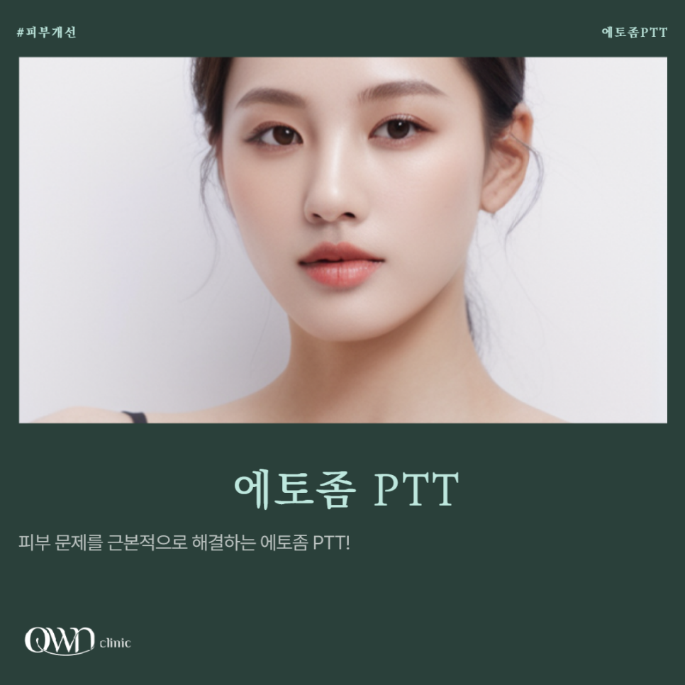 The Effects of Etosome PTT for Samsung-dong Acne Treatment: Skin Elasticity, Brightening, and Acne Control image 1