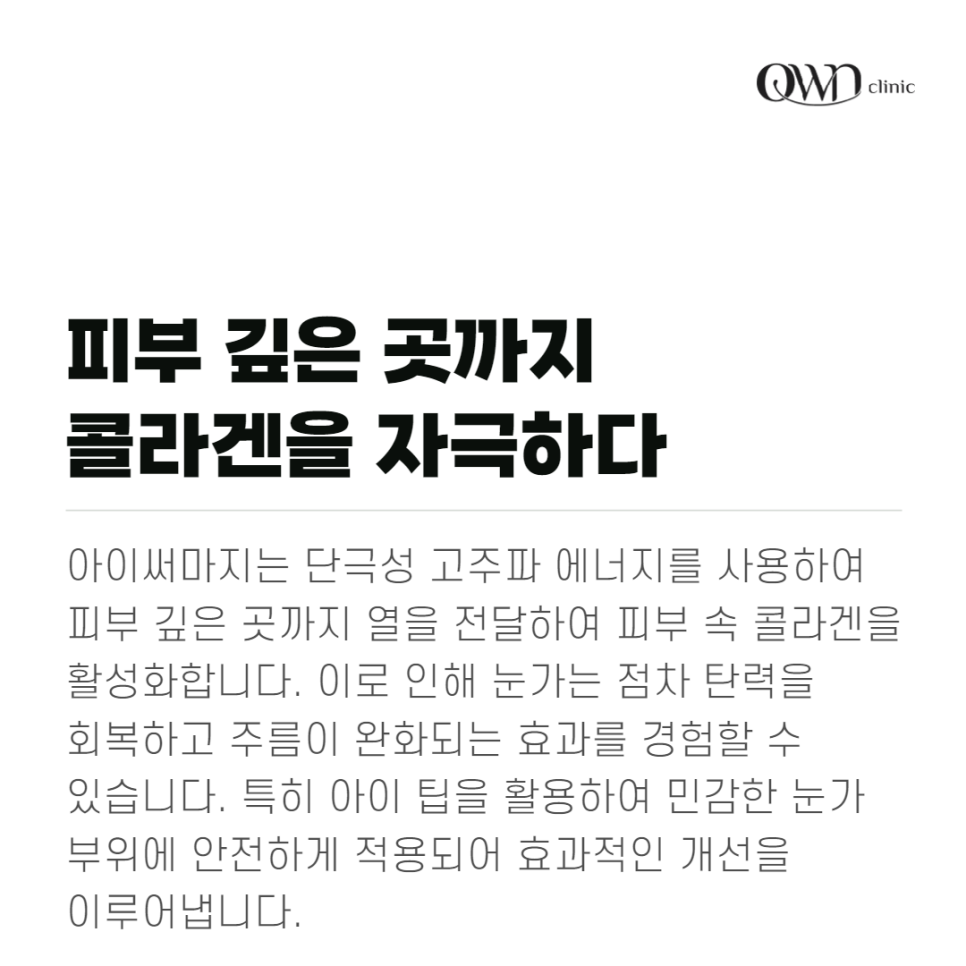 강남아이써마지, 가장 먼저 노화가 나타나는 눈가 어떻게 관리할까요? 관련 이미지 2