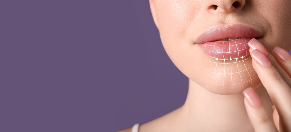 Samsung Station Dermatology Clinic, Lip Filler: It May Look Simple, but It Is by No Means a Simple Procedure. image 3