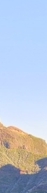 Gangnam Dermatology Clinic Hair Removal: How to Move Away from Irritating Self-Hair Removal | Laser Hair Removal image 11