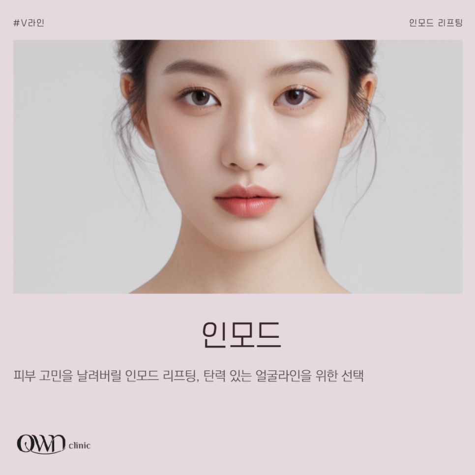 삼성역인모드, 처진 이중턱으로 스트레스 받고 계신가요? 관련 이미지 1
