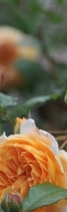 삼성역필러, 목주름, 숨기고만 싶으셨나요?간단한 시술로 자신감 UP하는 방법 관련 이미지 19