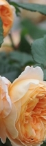 삼성역필러, 목주름, 숨기고만 싶으셨나요?간단한 시술로 자신감 UP하는 방법 관련 이미지 26