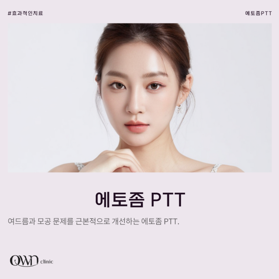강남에토좀PTT, 여드름 개선이 필요할 때, 선택해야 하는 이유 관련 이미지 1