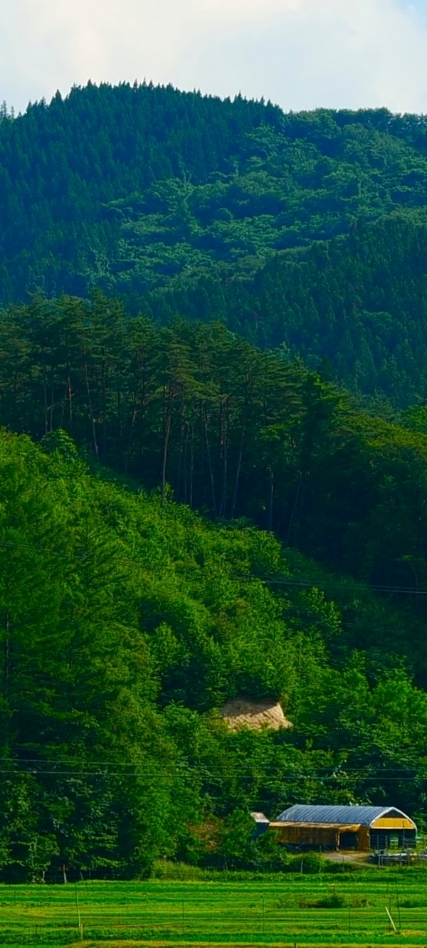 삼성동실리프팅, 맞춤형 디자인으로 더욱 만족스러운 결과를 기대할 수 있어요. 관련 이미지 33
