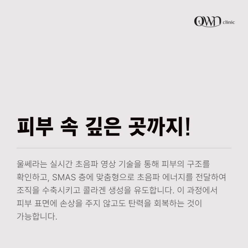 삼성동울쎄라, 떨어지는 피부탄력과 늘어진 턱살로 강력한 리프팅 효과가 필요하신가요? 관련 이미지 3