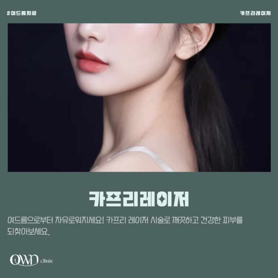삼성동 카프리레이저, 울긋불긋 여드름 자국, 아직 이 방법을 모르시나요? 관련 이미지 1