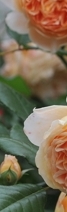 삼성역필러, 목주름, 숨기고만 싶으셨나요?간단한 시술로 자신감 UP하는 방법 관련 이미지 24