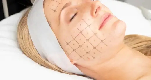 Why Thermage Is the Most Popular Treatment Recommended by Dermatology Clinics Near Samseong Station image 5