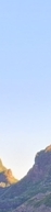 Gangnam Dermatology Clinic Hair Removal: How to Move Away from Irritating Self-Hair Removal | Laser Hair Removal image 12