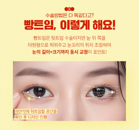 뒤밑트임, 흉터없이 순한 눈매로 관련 이미지 3