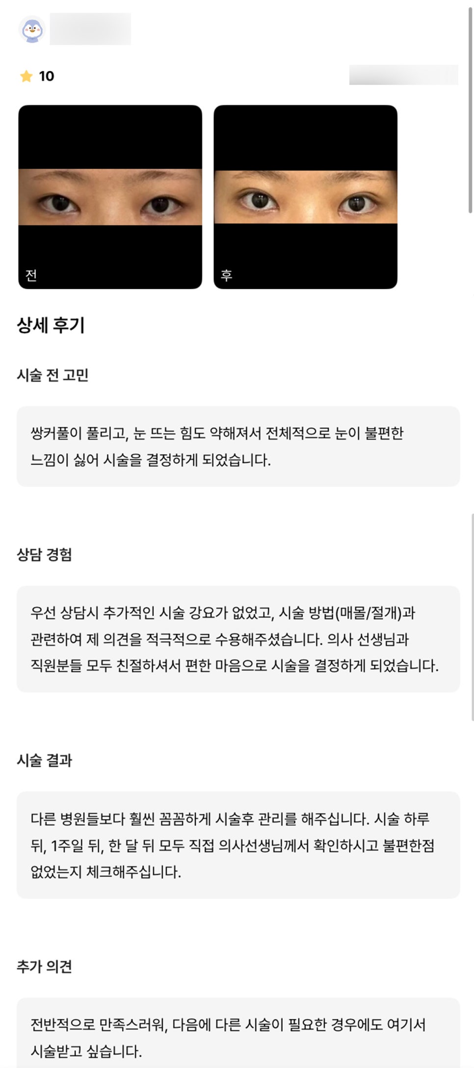 눈재수술 후기."의견을 적극적으로 수용해주셔서 좋았어요!" 관련 이미지 1
