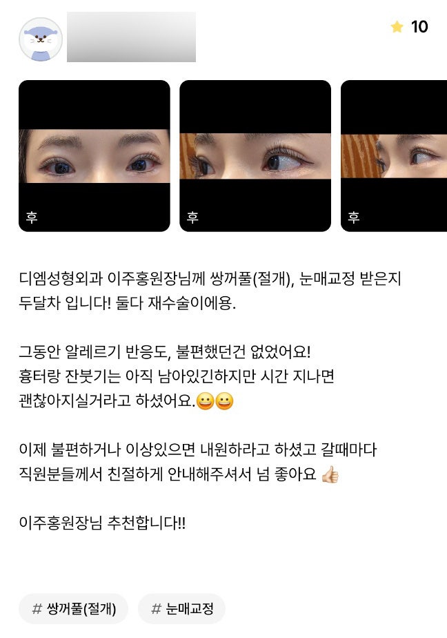 Revision Eye Surgery Review: “I Experienced No Discomfort, and the Staff Were Very Kind!” image 1