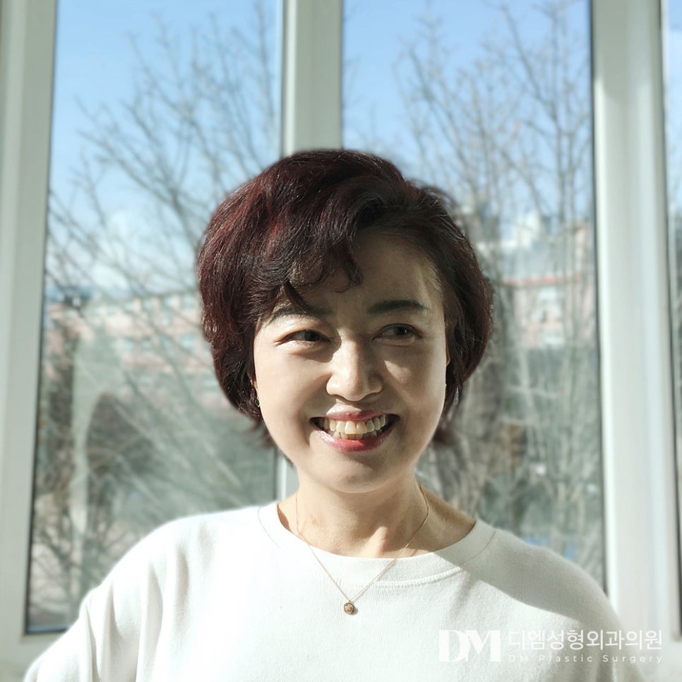 처지고 덮힌 눈매가 고민인 중년 모이세요 ! 관련 이미지 1