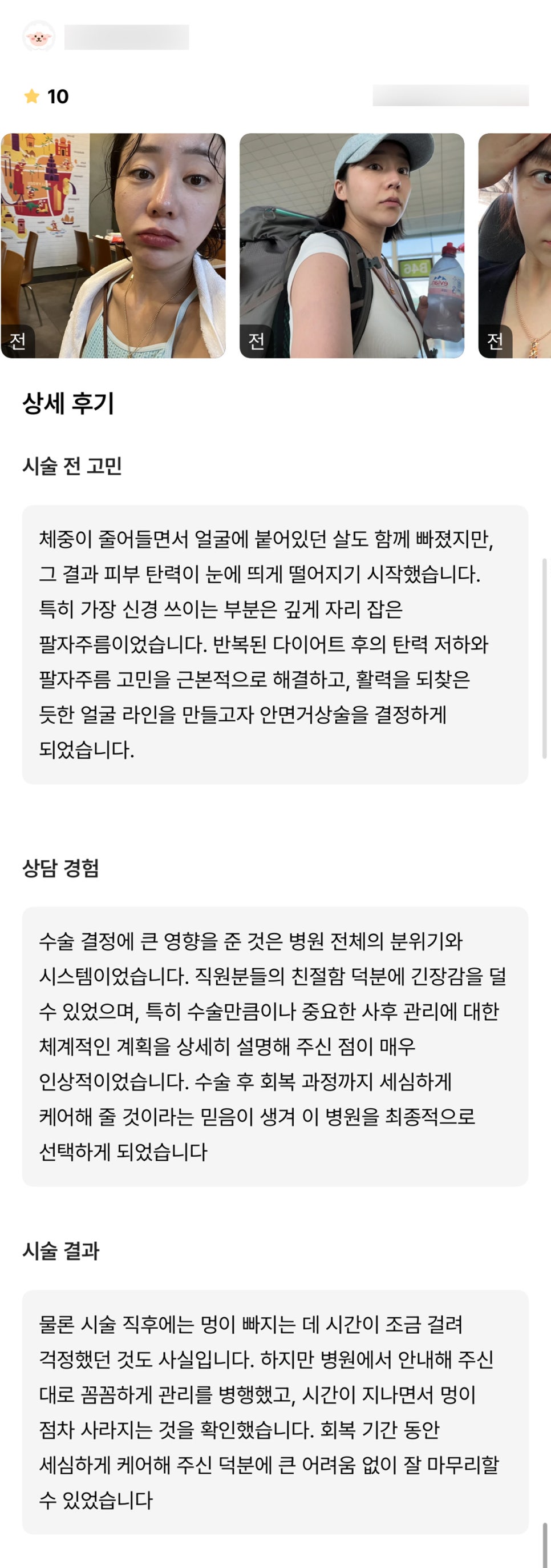 반거상 후기."회복기간이 힘들지 않아 좋았어요!" 관련 이미지 1