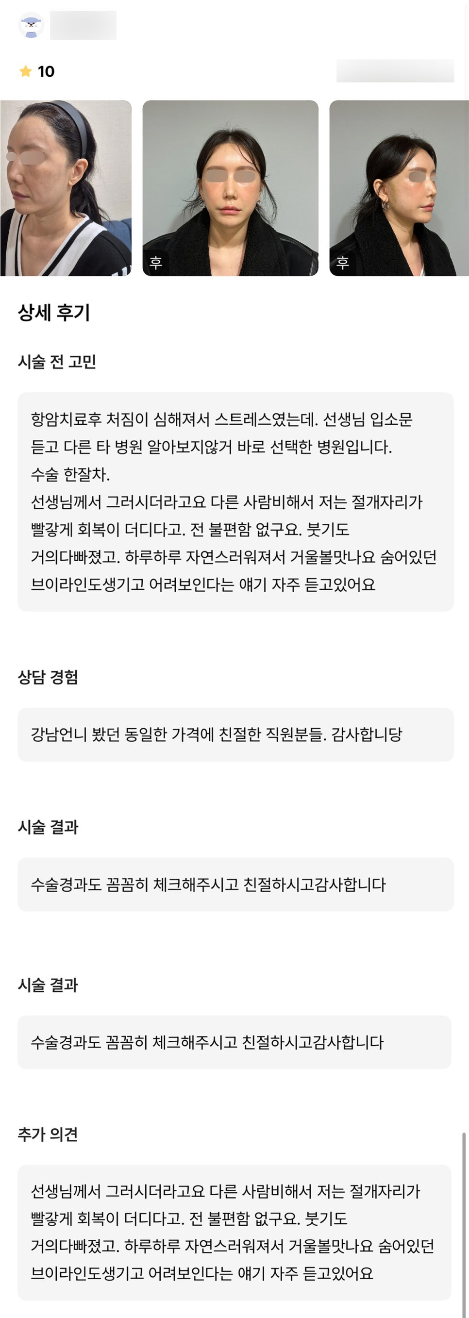 안면거상 후기."하루하루 자연스러워져서 거울 볼 맛 나요!" 관련 이미지 1
