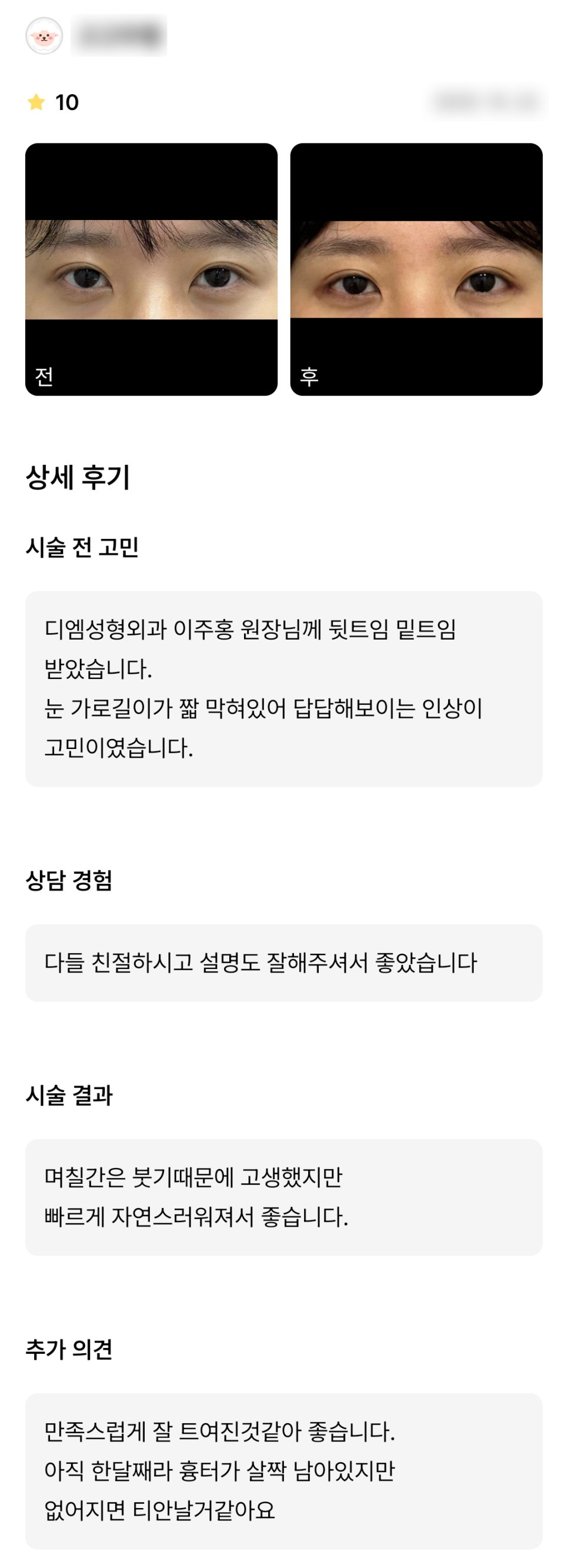 디엠 빵트임 수술후기, “만족스럽게 잘 트여진 것 같아 좋습니다!” 관련 이미지 1