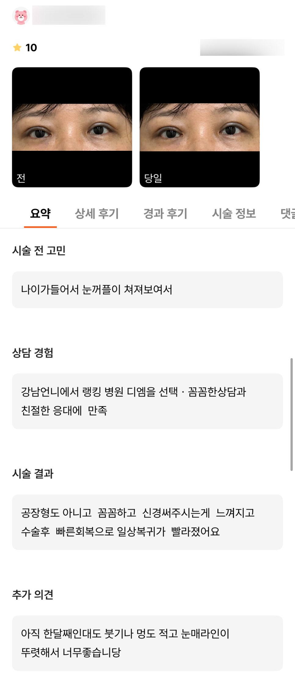 상안검 후기."붓기나 멍도 적고 눈매 라인이 뚜렷해서 너무 좋습니당 !" 관련 이미지 1