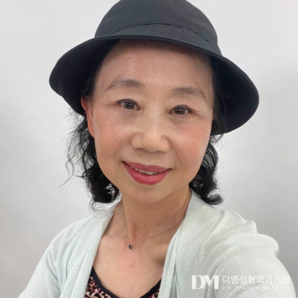 Escape Drooping Eyes and Renew Your Eye Area for a More Youthful Look image 1