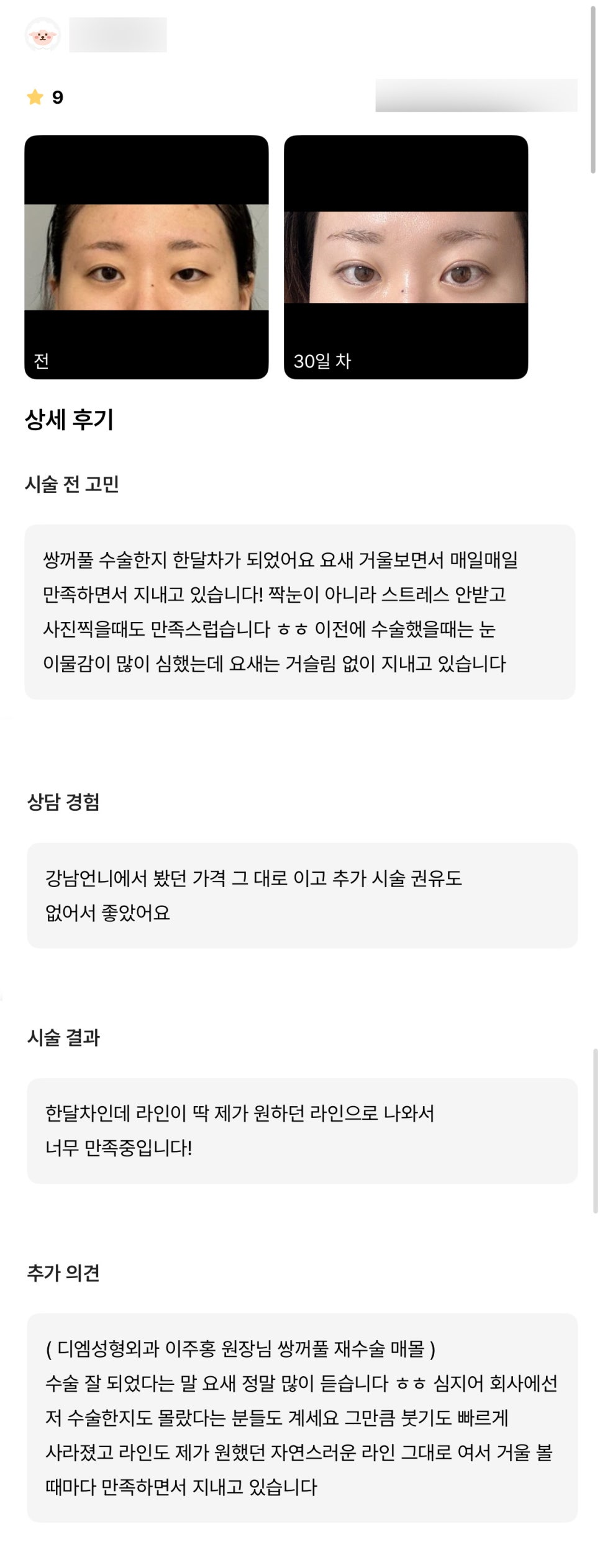 Double Eyelid Revision Surgery Review. "The line stayed exactly the natural line I wanted, so I’ve been satisfied every time I look in the mirror!" image 1