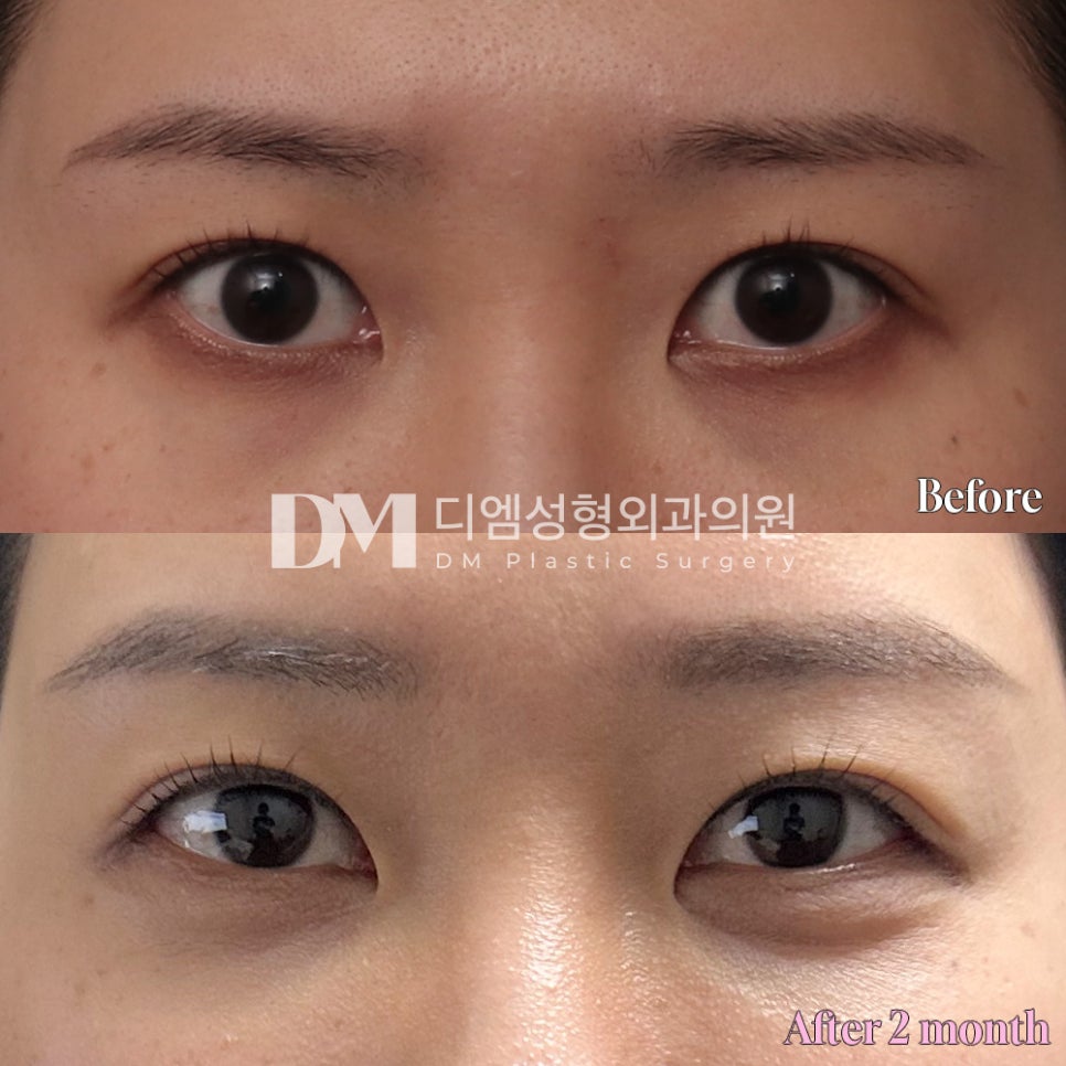 Review of Ppangtwin. “My expression looks softer than before, and my eyes look clearer!” image 2