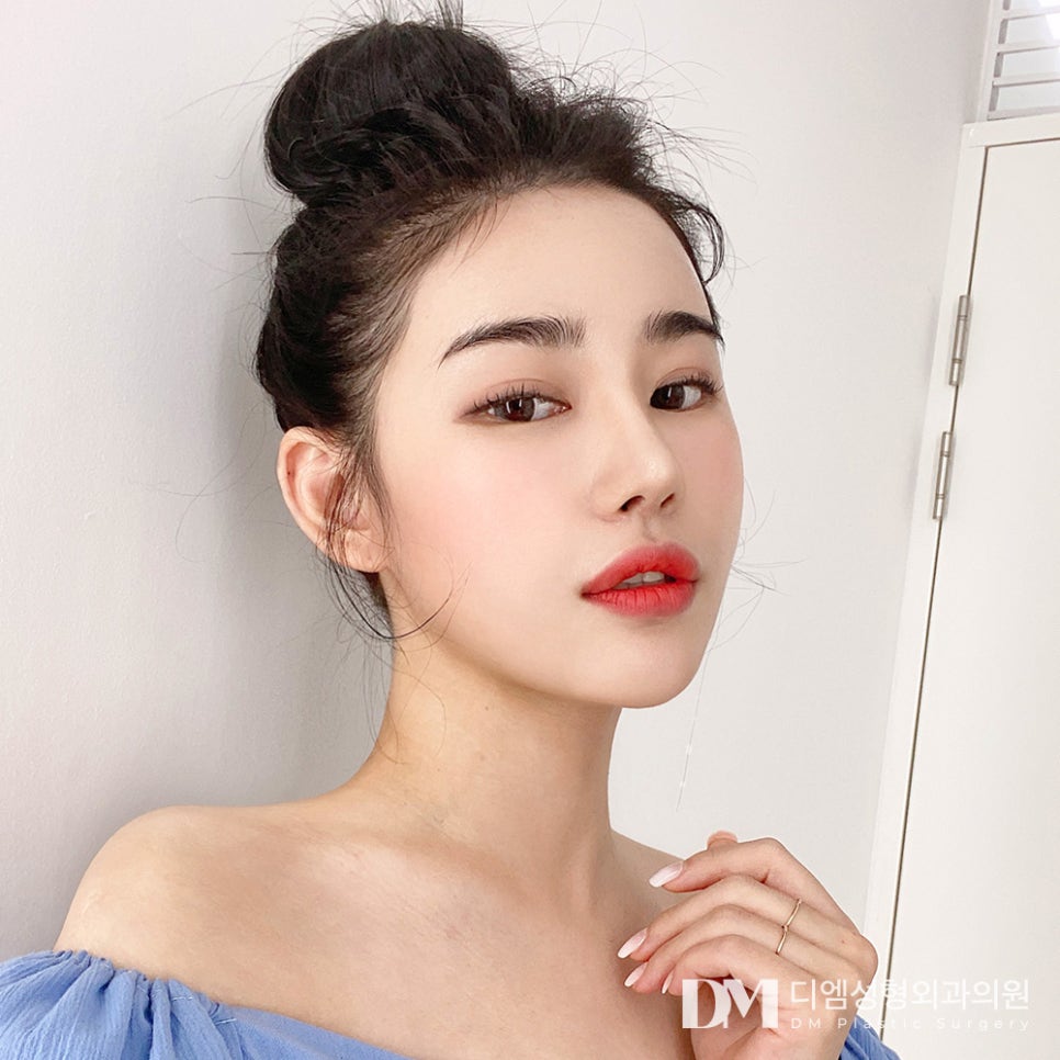 복코성형 , 얼굴의 균형과 조화를 맞춰 관련 이미지 1