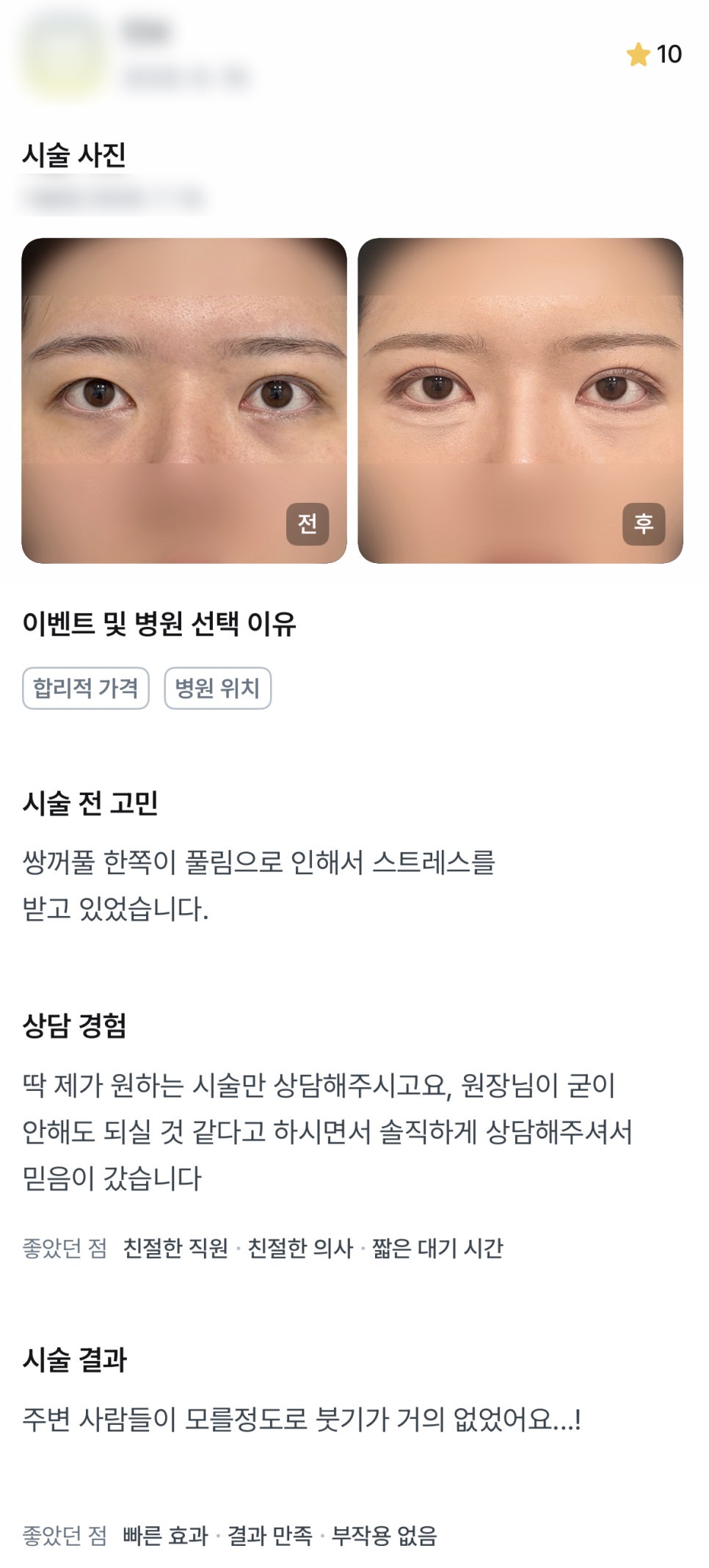 디엠 눈재수술/눈매교정 수술후기, &ldquo;솔직하게 상담해주셔서 믿음이 갔어요!&rdquo; 관련 이미지 1