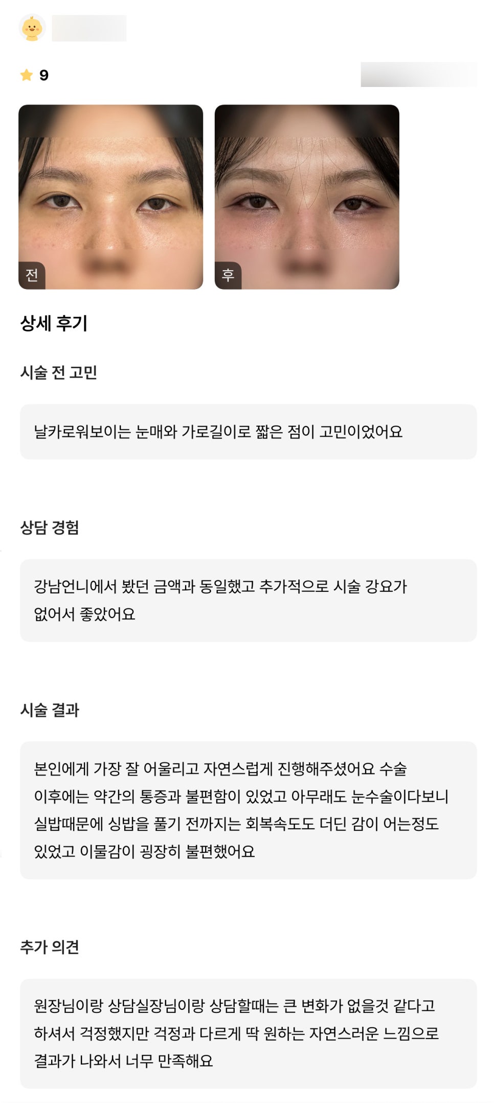 Ppang-tteum Review. “I’m so satisfied that the result came out with exactly the natural look I wanted” image 1