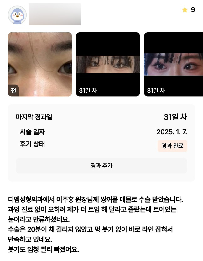 눈성형 후기."붓기도 빨리빠지고 멍이 없어서 만족해요!" 관련 이미지 1