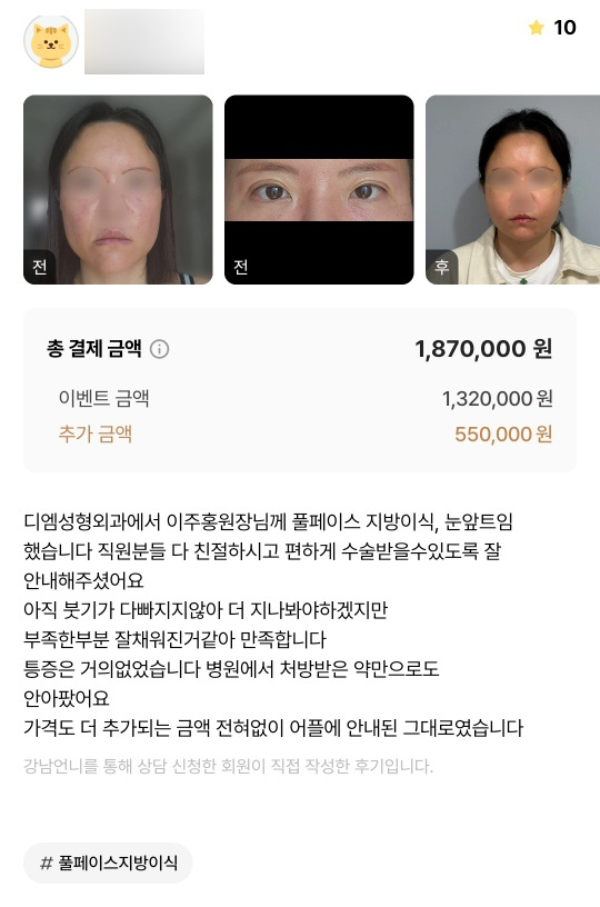 얼굴지방이식 후기."부족한 부분 잘 채워진 것 같아 만족 합니다!" 관련 이미지 1