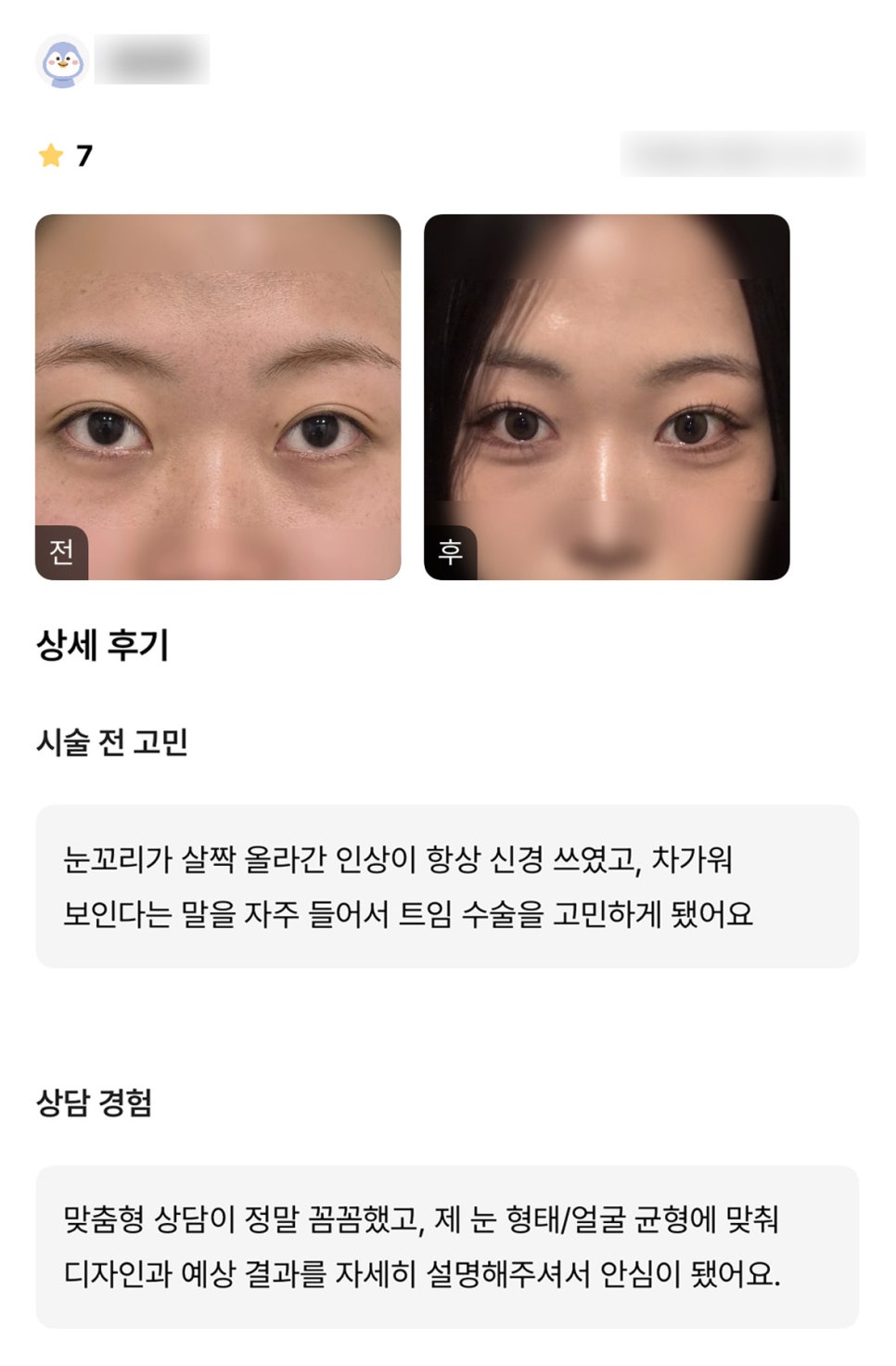 뒤밑트임 후기."꼼꼼한 상담에 안심이 됐어요!" 관련 이미지 1