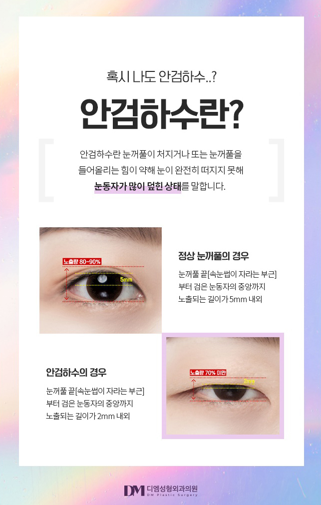 Eye Correction Surgery: Transform a Dull, Heavy-Looking Eye Shape into a Clear, Brighter One! image 3
