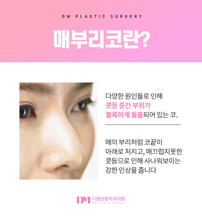 매부리코 , 어느각도에서든 당당한 코 라인으로 관련 이미지 2