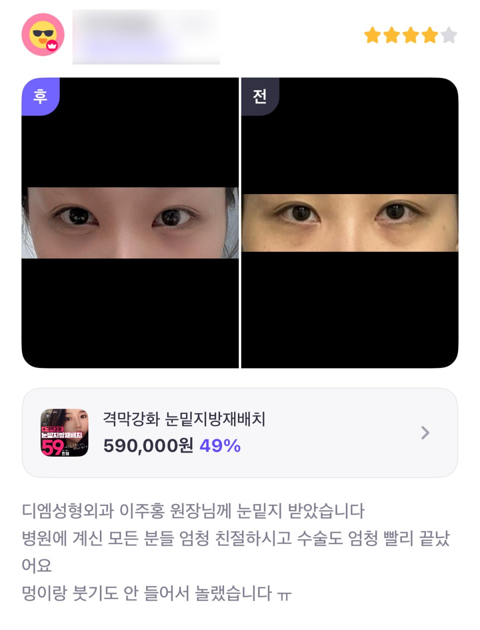 눈밑지방재배치 후기."멍이랑 붓기가 없어서 놀랬어요!" 관련 이미지 1