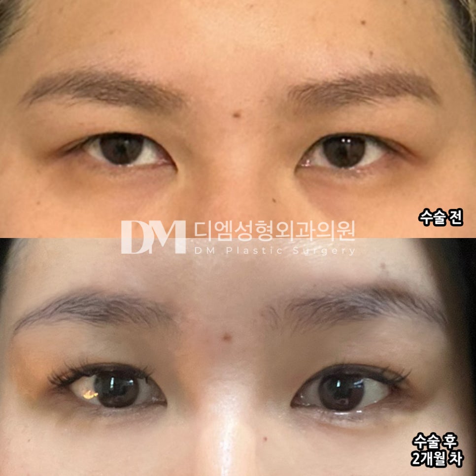 Bang Teum Review. "I’m so happy and satisfied!" image 2