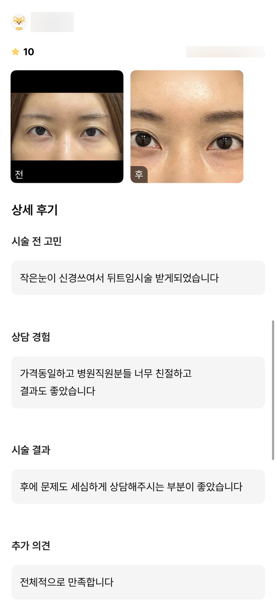 뒤밑트임 후기."전체적으로 만족해요!" 관련 이미지 1
