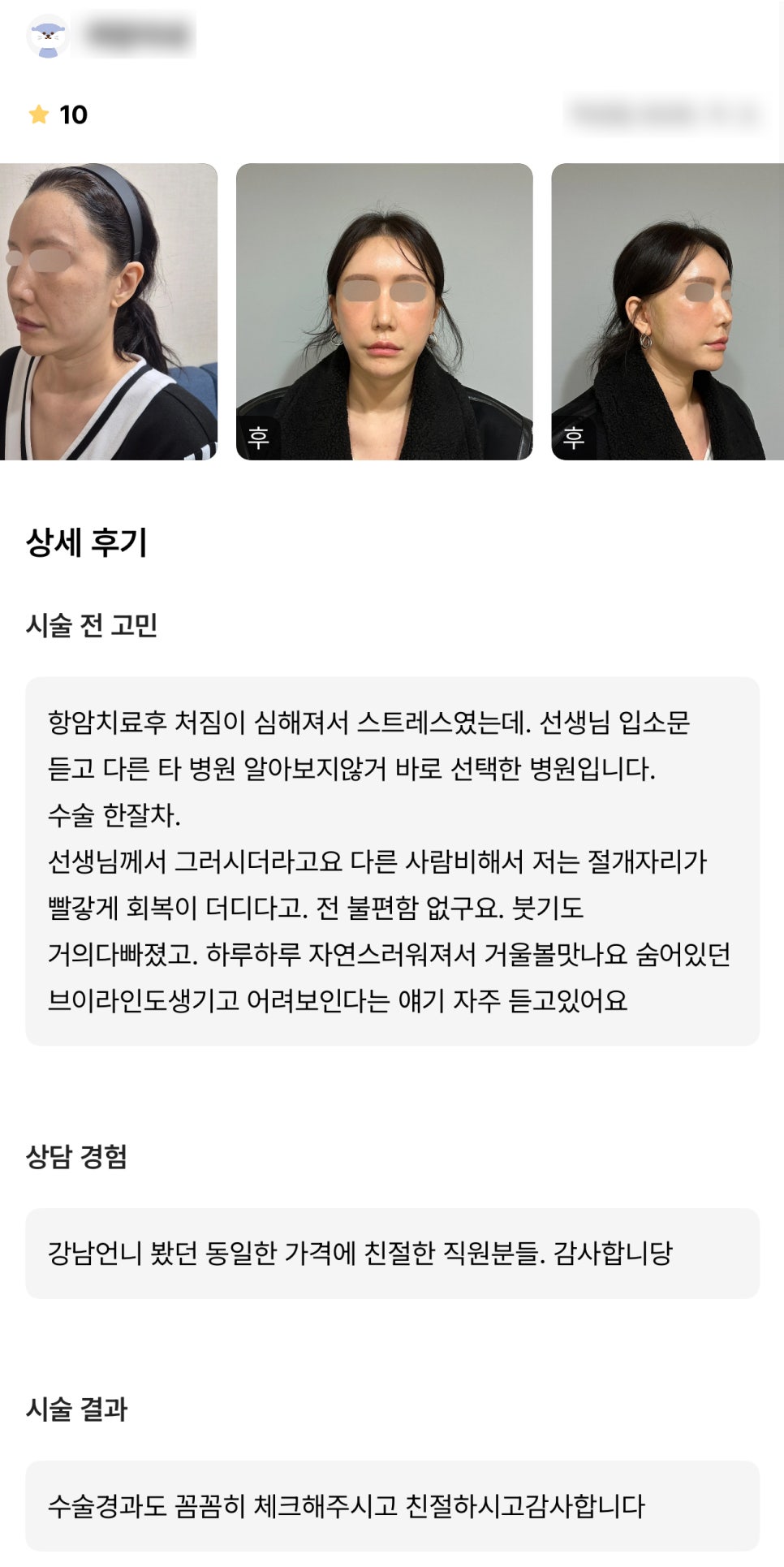 디엠 안면거상 수술후기, &ldquo;숨어있던 브이라인도 생기고 어려 보인다는 얘기 자주 들어요!&rdquo; 관련 이미지 1