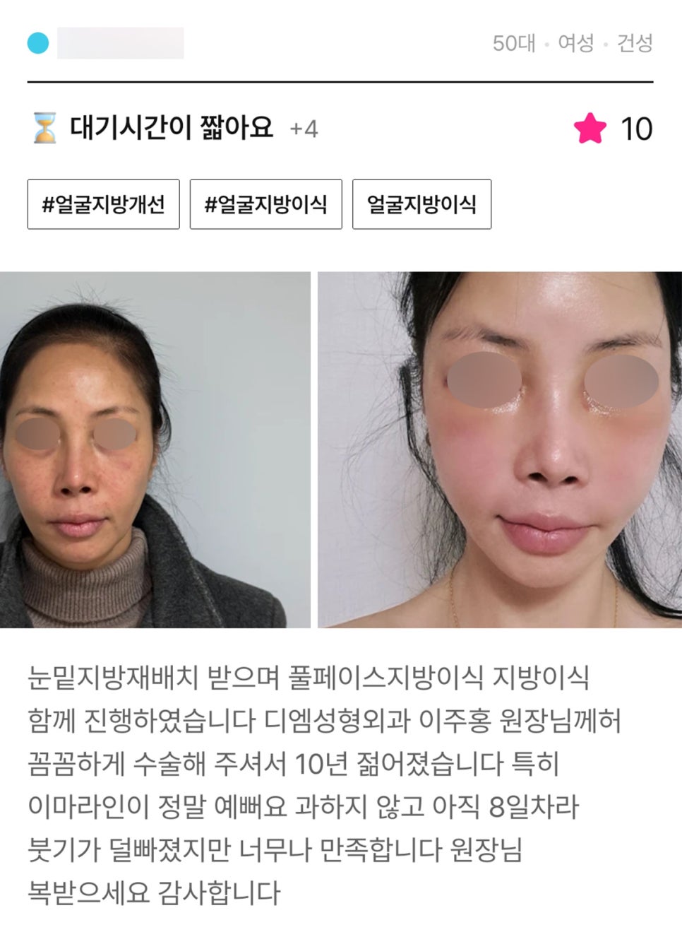 얼굴지방이식 후기."붓기가 덜 빠졌지만 너무나 만족합니다 원장님 복받으세요 감사합니다!" 관련 이미지 1