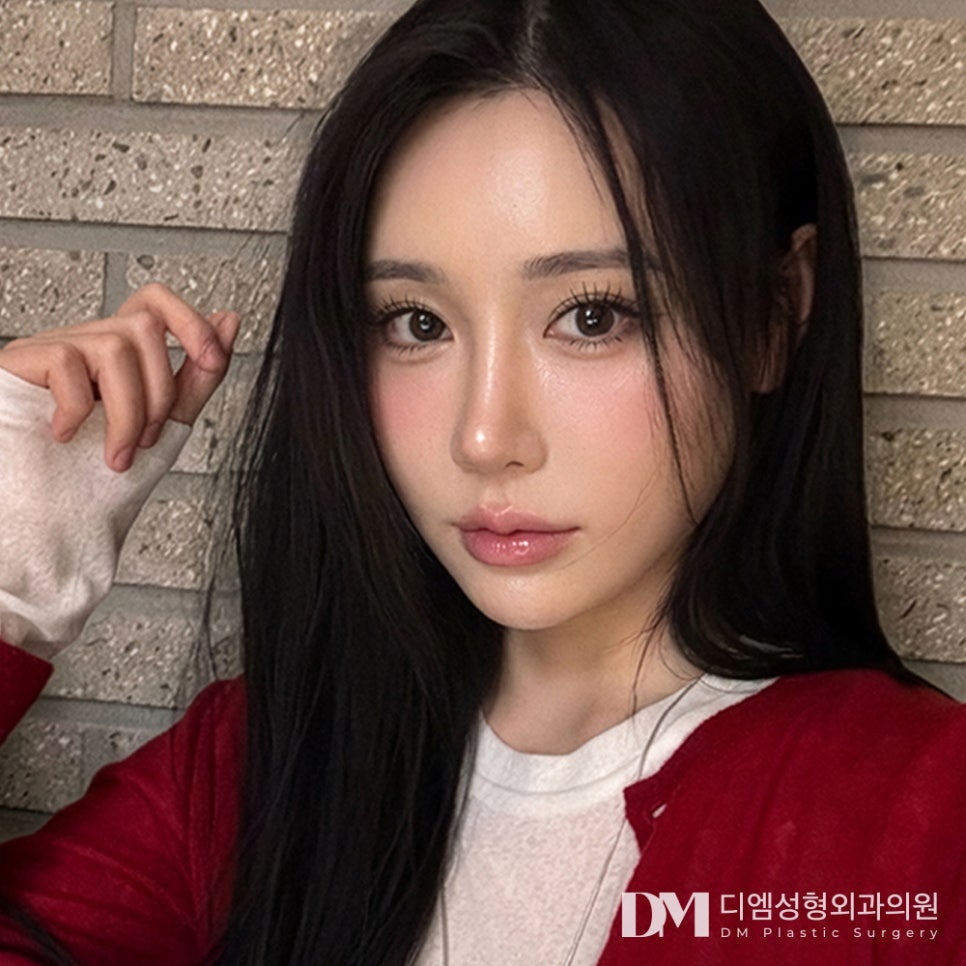 디엠 뒤밑트임 전후사진, 자연스럽게 트인 눈매 가능할까? 관련 이미지 3